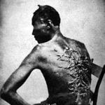 Flagellated man