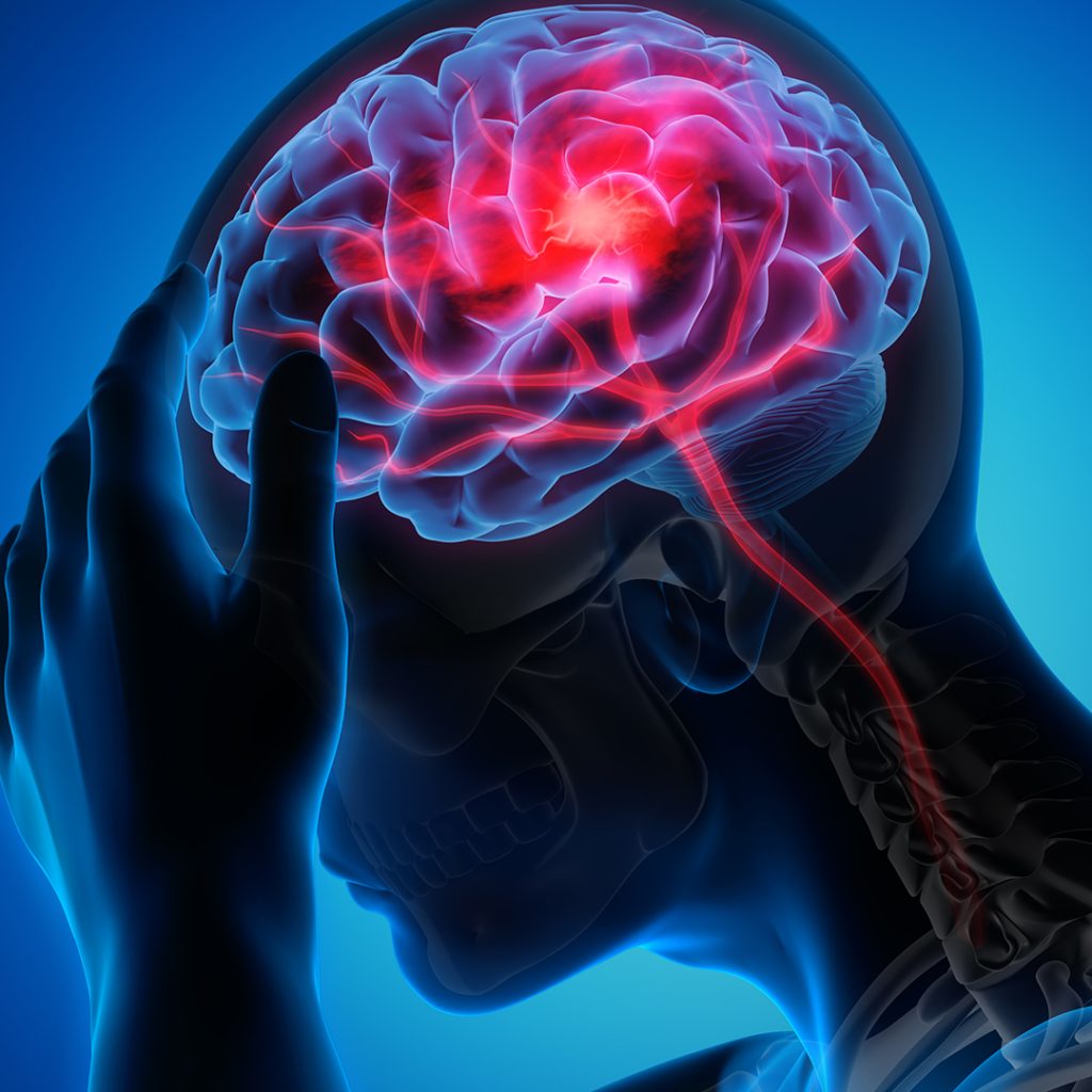 Fake man holding head with brain synapsis exposed